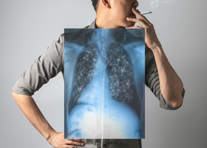 Bahaya Merokok dan Pencegahannya Terutama di Kalangan Remaja