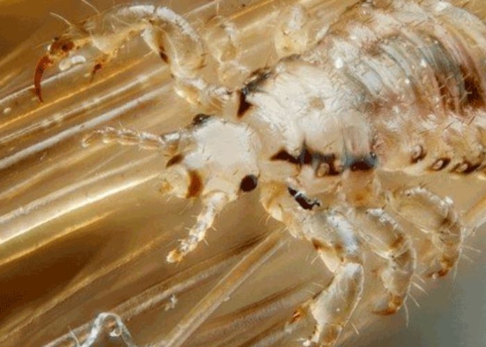 7 Cara Hilangkan Kutu Rambut yang Mengganggu, Bisa Dilakukan Dengan Bahan Alami