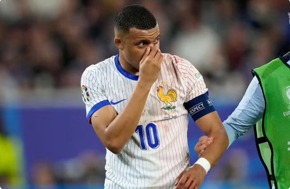 Pernyataan Federasi Sepak Bola Prancis, Nosebreak Alert! Kylian Mbappé Tetap Fight dengan Masker