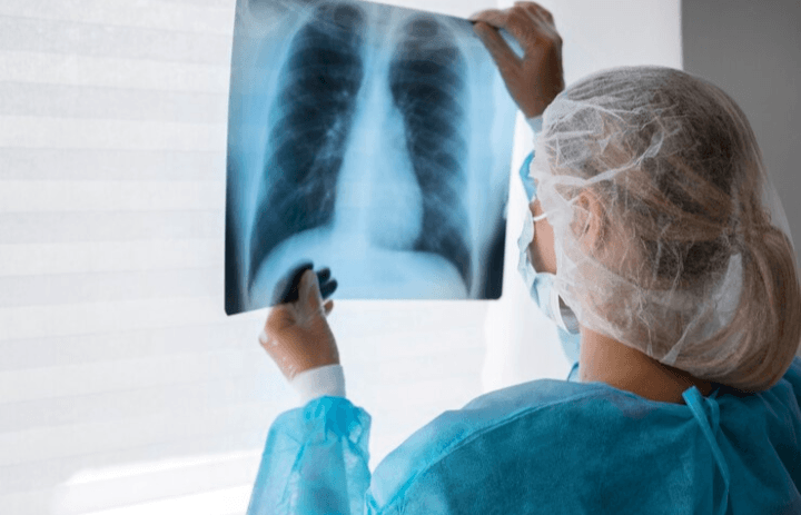 6 Tanda Paru-Paru Anda Mengalami Masalah Kesehatan, Jangan Abaikan!