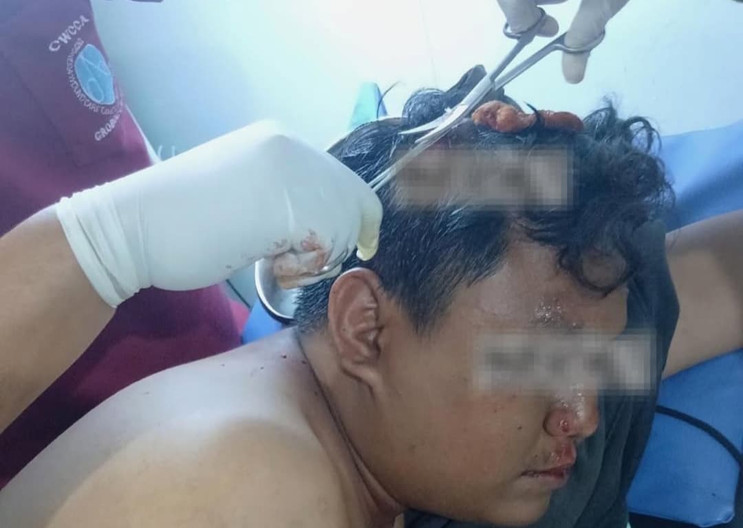 Gerombolan Kreak Bacok Pengendara Motor di Pantura Gringsing, Korban Luka di kepala