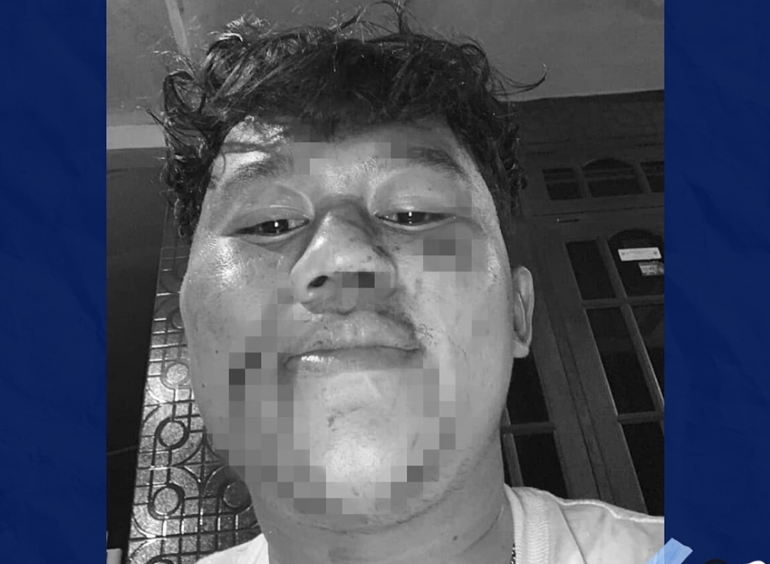 Vocalist Band Hardcore asal Malang Dikeroyok dan Dibacok saat Tampil di Kota Batu, Polisi Lakukan Penyelidikan