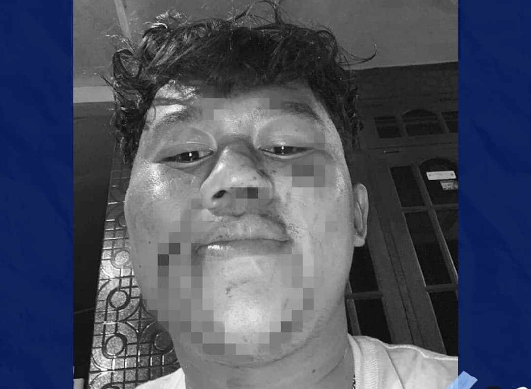 Vocalist Band Hardcore asal Malang Dikeroyok dan Dibacok saat Tampil di Kota Batu, Polisi Lakukan Penyelidikan