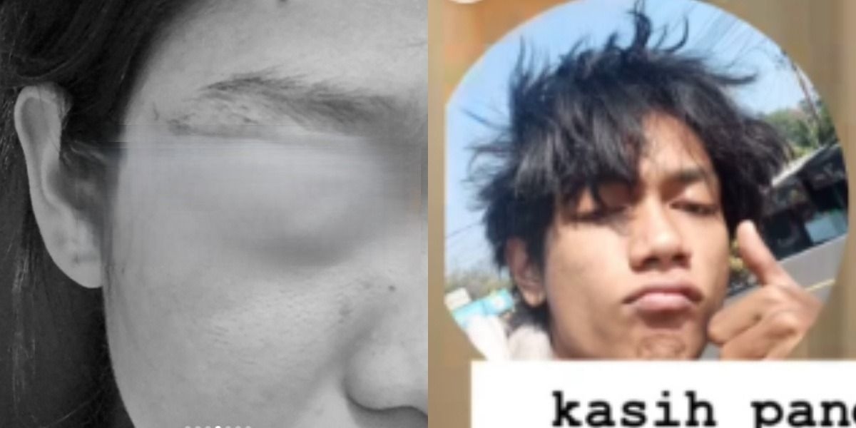 FAKTA TERBARU! 4 Poin Pengakuan Korban yang Viral Ditendang Pacar, Diduga Gegara Masalah Utang Selama 3 Tahun Jalin Hubungan